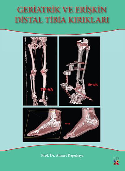 GERİATRİK VE ERİŞKİN DİSTAL TİBİA KIRIKLARI - kitap AHMET KAPUKAYA